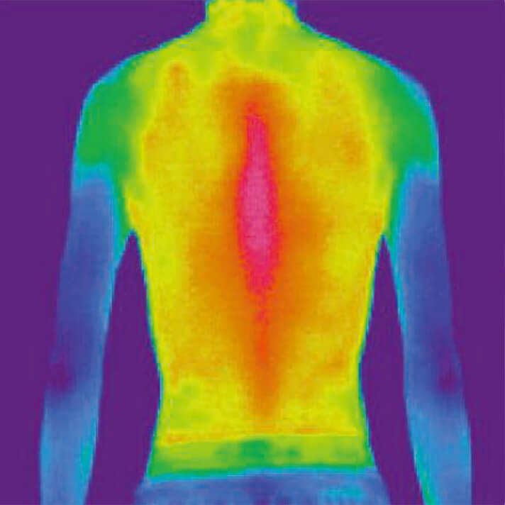 thermo-normal.jpg